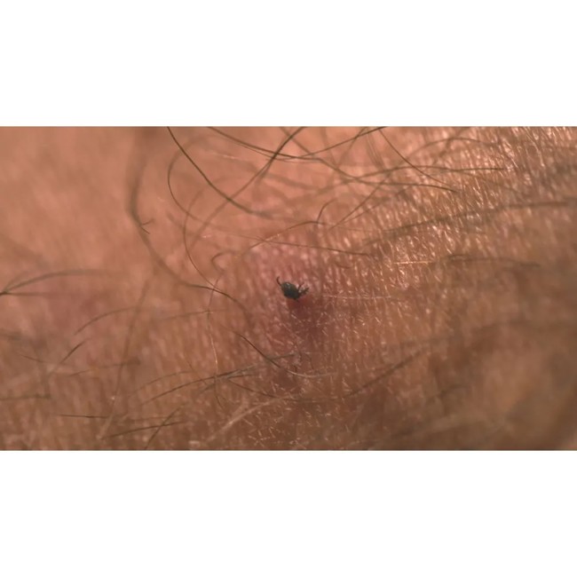 Accesorio Light My Fire Tick Remover Tool